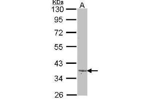 WB Image Sample (30 ug of whole cell lysate) A: A431 , 10% SDS PAGE antibody diluted at 1:1000 (LEFTY2 antibody)