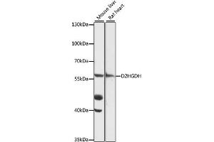 Western blot analysis of extracts of various cell lines, using D2HGDH antibody (ABIN7266669) at 1:1000 dilution. (D2HGDH antibody  (AA 322-521))