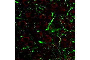 Immunohistochemistry staining of CD107a (red) in tissue sections of murine brain expressing GFP in some of its neurons (green). (LAMP1 antibody)