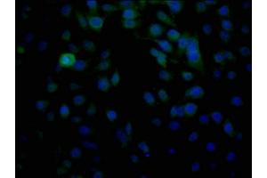 Immunofluorescence (IF) image for anti-Major Histocompatibility Complex, Class I, B (HLA-B) (AA 243-308) antibody (ABIN7155555)