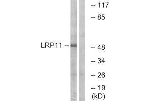 Western blot analysis of extracts from Jurkat cells, using LRP11 antibody. (LRP11 antibody)