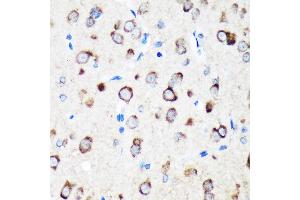 Immunohistochemistry of paraffin-embedded Rat brain using TXNDC12 Rabbit pAb (ABIN7270800) at dilution of 1:100 (40x lens). (TXNDC12 antibody  (AA 93-172))