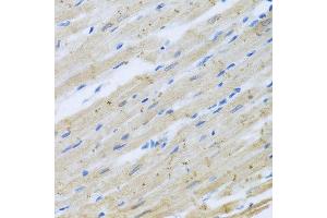 Immunohistochemistry of paraffin-embedded rat heart using CLIP1 antibody at dilution of 1:100 (x40 lens). (CLIP1 antibody)