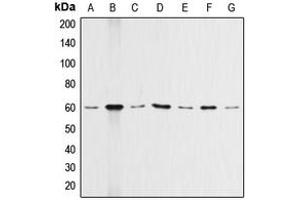 Western blot analysis of AKT expression in HeLa (A), A549 (B), Raw264.