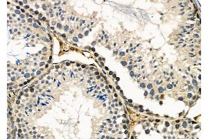 ABIN6259220 and ABIN6273605 at 1/100 staining Mouse testis tissue by IHC-P.