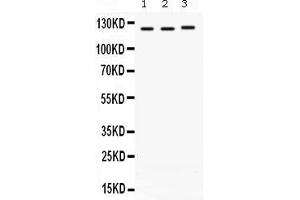 Western blot analysis of CRM1 expression in rat cardiac muscle extract ( Lane 1), mouse brain extract ( Lane 2) and A549 whole cell lysates ( Lane 3). (XPO1 antibody  (AA 966-1071))