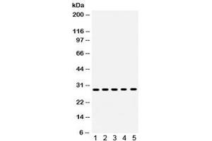 Western blot testing of human 1) MCF7, 2) MM231, 3) MM453, 4) SKOV and 5) HeLa lysate with XBP1 antibody. (XBP1 antibody)