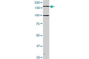 Western Blotting (WB) image for anti-TEK Tyrosine Kinase, Endothelial (TEK) (AA 66-185) antibody (ABIN793004) (TEK antibody  (AA 66-185))