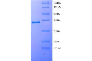 Solute Carrier Family 25 (Mitochondrial Carrier, Citrate Transporter), Member 1 (Slc25a1) (AA 47-87), (partial) protein (GST tag) (Slc25a1 Protein (AA 47-87, partial) (GST tag))
