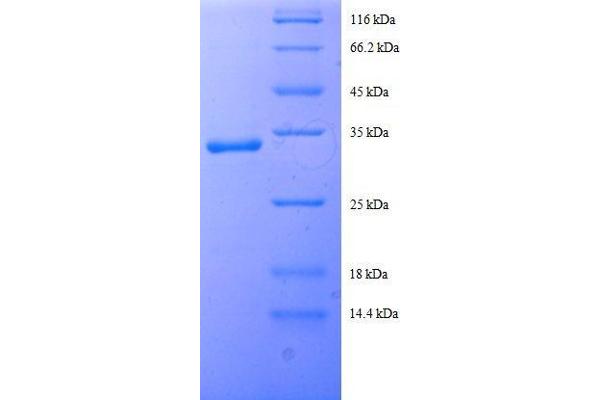 Slc25a1 Protein (AA 47-87, partial) (GST tag)