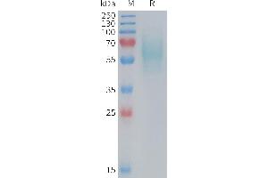 Mouse 5T4 Protein, His Tag on SDS-PAGE under reducing condition.