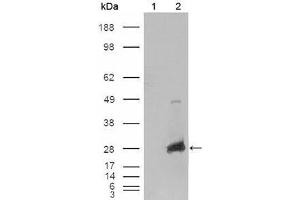 Western Blot showing CRYAB antibody used against HEK293T cells transfected with the pCMV6-ENTRY control (1) and pCMV6-ENTRY CRYAB cDNA (2). (CRYAB antibody  (AA 1-175))