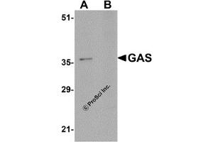 Western Blotting (WB) image for anti-Gastrin (GAST) (C-Term) antibody (ABIN1030407) (Gastrin antibody  (C-Term))