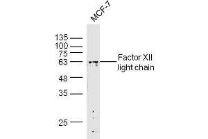 MCF-7 lysates probed with Factor I heavy chain Polyclonal Antibody, Unconjugated  at 1:300 dilution and 4˚C overnight incubation. (Factor I Heavy Chain (AA 261-360) antibody)
