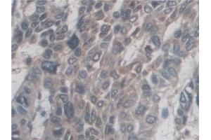 Immunohistochemistry (IHC) image for anti-CD209 (CD209) (AA 70-404) antibody (ABIN7444307)