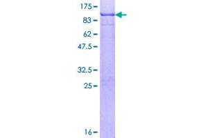 SOX9 Protein (AA 1-509) (GST tag)