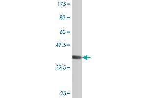 Western Blot detection against Immunogen (36. (MYH3 antibody  (AA 2-100))