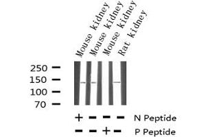 Western blot analysis of Phospho-eNOS (Thr494) expression in various lysates (ENOS antibody  (pThr495))