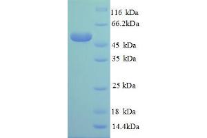 RPL14 Protein (AA 2-214, partial) (GST tag)