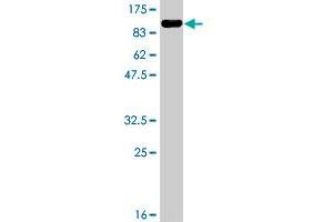 Western Blot detection against Immunogen (86. (CBS antibody  (AA 1-551))