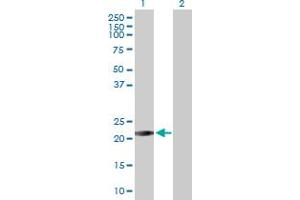 Western Blot analysis of RAB26 expression in transfected 293T cell line by RAB26 MaxPab polyclonal antibody.