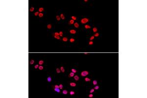 Immunofluorescence analysis of HeLa cells using XRCC5 antibody. (XRCC5 antibody)