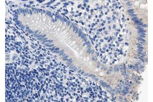Immunohistochemistry (IHC) image for anti-Protein Phosphatase 1, Regulatory (Inhibitor) Subunit 1B (PPP1R1B) (pThr34) antibody (ABIN6255670)