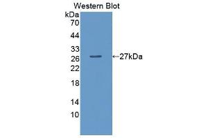 Western blot analysis of the recombinant protein. (LPO antibody  (AA 351-589))
