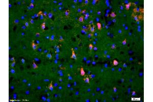 Formalin-fixed and paraffin-embedded rat brain labeled with Anti-Phospho-TAK1(Thr184/187) Polyclonal Antibody, Unconjugated (ABIN746348) 1:200, overnight at 4°C, The secondary antibody was Goat Anti-Rabbit IgG, Cy3 conjugated used at 1:200 dilution for 40 minutes at 37°C. (TR4 antibody  (pThr184, pThr187))