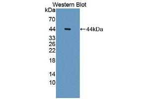 Figure. (CDH15 antibody  (AA 60-374))