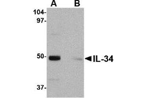 Western Blotting (WB) image for anti-Interleukin 34 (IL34) (Middle Region) antibody (ABIN1030960)