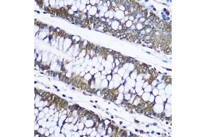 Immunohistochemistry of paraffin-embedded human placenta using Ubiquitin Rabbit pAb (ABIN3022990, ABIN3022991, ABIN3022992 and ABIN6219334) at dilution of 1:100 (40x lens). (Ubiquitin B antibody  (AA 1-76))