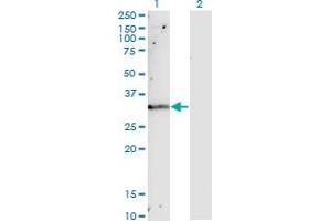 Western Blot analysis of TIMP1 expression in transfected 293T cell line by TIMP1 monoclonal antibody (M01), clone 4D12. (TIMP1 antibody  (AA 1-169))