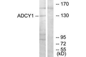 Western blot analysis of extracts from COLO205 cells, using ADCY1 Antibody. (ADCY1 antibody  (AA 231-280))