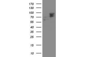 Western Blotting (WB) image for anti-Aldehyde Dehydrogenase 3 Family, Member A2 (ALDH3A2) antibody (ABIN1496596) (ALDH3A2 antibody)