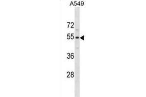 Western Blotting (WB) image for anti-Pseudouridylate Synthase 10 (PUS10) antibody (ABIN5020829) (PUS10 antibody)