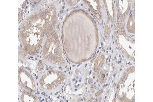 ABIN6267538 at 1/200 staining human kidney tissue sections by IHC-P.