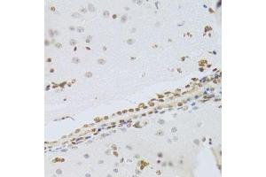 Immunohistochemistry of paraffin-embedded mouse brain using HMGB1 Antibody. (HMGB1 antibody  (AA 100-200))