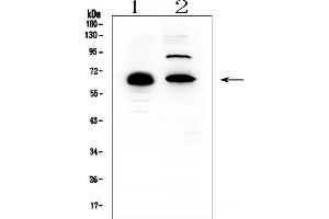 Western blot analysis of CCDC36 using anti-CCDC36 antibody (ABIN6719645). (CCDC36 antibody  (AA 172-472))
