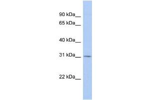 WB Suggested Anti-TSPAN12 Antibody Titration:  0. (TSPAN12 antibody  (Middle Region))