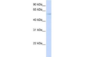 WB Suggested Anti-RIPK3 Antibody Titration:  0. (RIPK3 antibody  (N-Term))