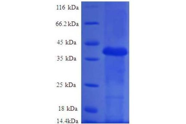 RPL36AL Protein (AA 1-106, full length) (GST tag)