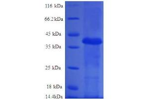 Ribosomal Protein L36a-Like (RPL36AL) (AA 1-106), (full length) protein (GST tag)