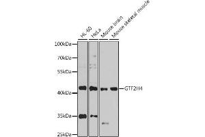 Western blot analysis of extracts of various cell lines, using GTF2H4 antibody  at 1:1000 dilution.