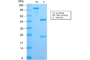 SDS-PAGE Analysis Purified PAX8 Recombinant Rabbit Monoclonal Antibody (PAX8/2774R). (Recombinant PAX8 antibody  (AA 60-261))