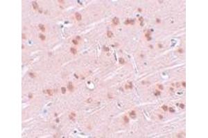 Immunohistochemistry (IHC) image for anti-Synaptogyrin 1 (SYNGR1) (Middle Region) antibody (ABIN1031113) (Synaptogyrin 1 antibody  (Middle Region))