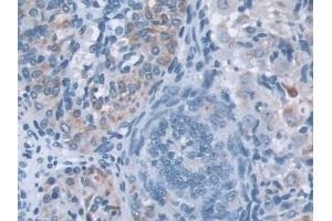 DAB staining on IHC-P; Samples: Mouse Ovary Tissue (IQGAP1 antibody  (AA 1276-1657))