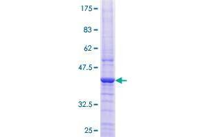 B9D1 Protein (AA 1-153) (GST tag)