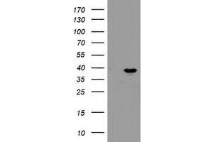 Western Blotting (WB) image for anti-Peptidylprolyl Isomerase (Cyclophilin)-Like 6 (PPIL6) antibody (ABIN1500367)