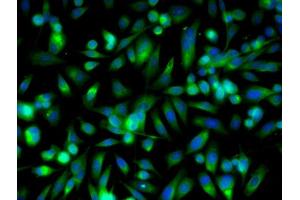 Image provided by One World Lab validation program. (SIRT5 antibody  (AA 120-170))